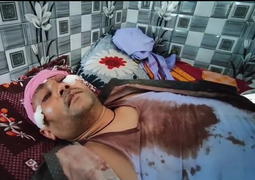 बाइक सवार बदमाशों ने केला प्लांट मालिक पर हमला कर नगदी व जेवरात लूटे, हालत गंभीर